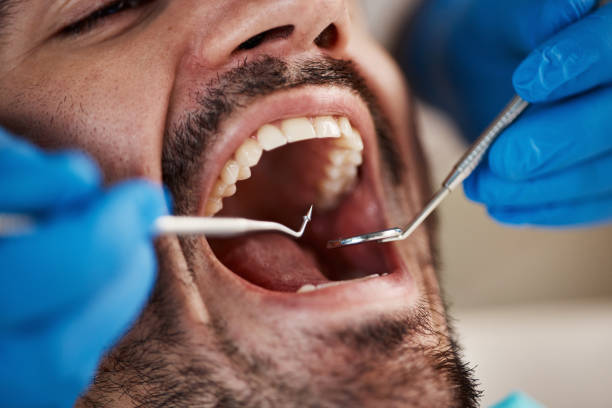 Best Affordable Emergency Dental Care  in Harrison, WI